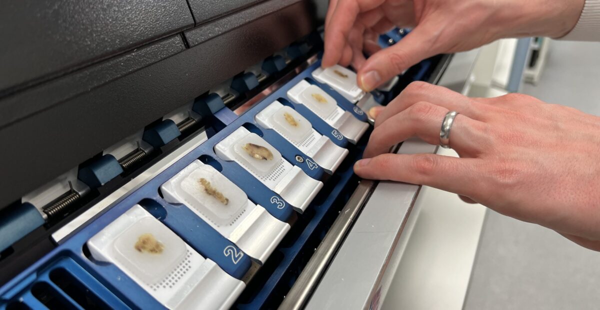 A close up of hands pressing buttons on a piece of lab equipment.