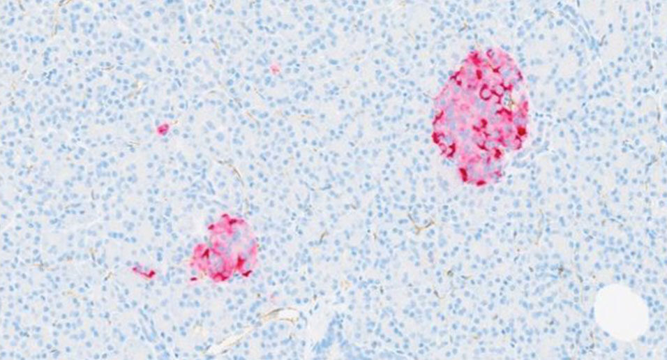 Microscope image of pancreatic tissue showing two clusters of cells stained bright pink against a pale background of many small blue-stained cells.