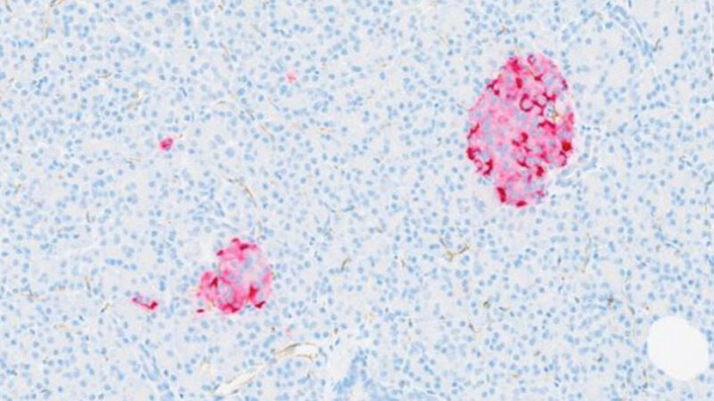 Microscope image of pancreatic tissue showing two clusters of cells stained bright pink against a pale background of many small blue-stained cells.
