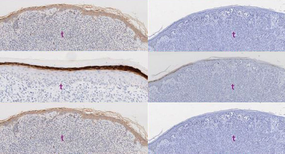 Six microscope images of skin tissue in two columns, with the left column showing brown surface staining and the right column showing no staining. Each image has a small ‘t’ marking the tissue layer.