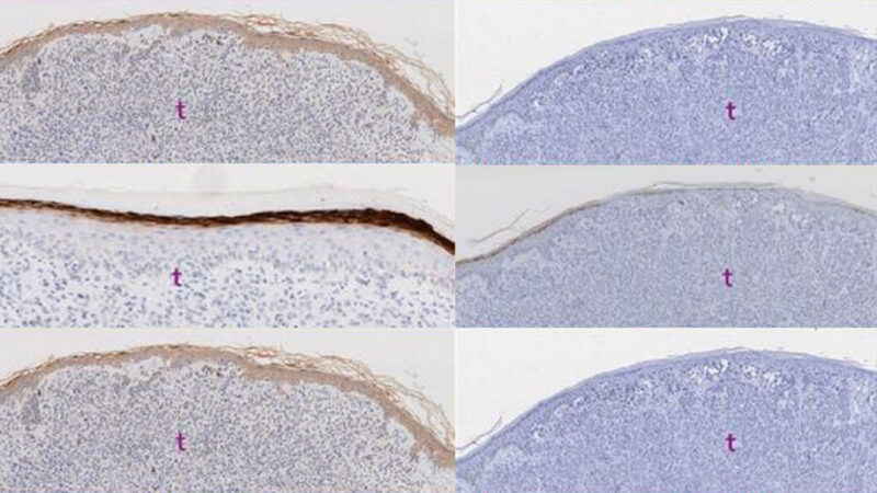 Six microscope images of skin tissue in two columns, with the left column showing brown surface staining and the right column showing no staining. Each image has a small ‘t’ marking the tissue layer.