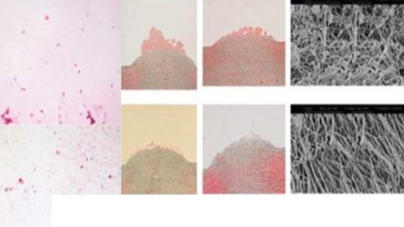 Several images showing samples of tissue at different magnifications. The pictures on the left and in the middle show soft pink‑coloured tissue, while the two images on the right show a close‑up, black‑and‑white view of the tissue’s fibrous structure.