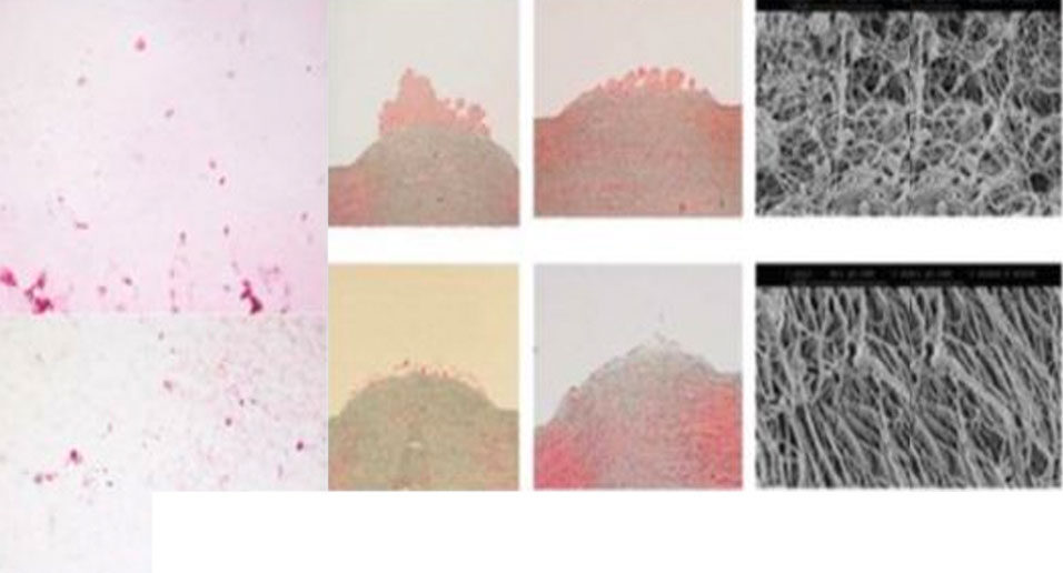 Several images showing samples of tissue at different magnifications. The pictures on the left and in the middle show soft pink‑coloured tissue, while the two images on the right show a close‑up, black‑and‑white view of the tissue’s fibrous structure.