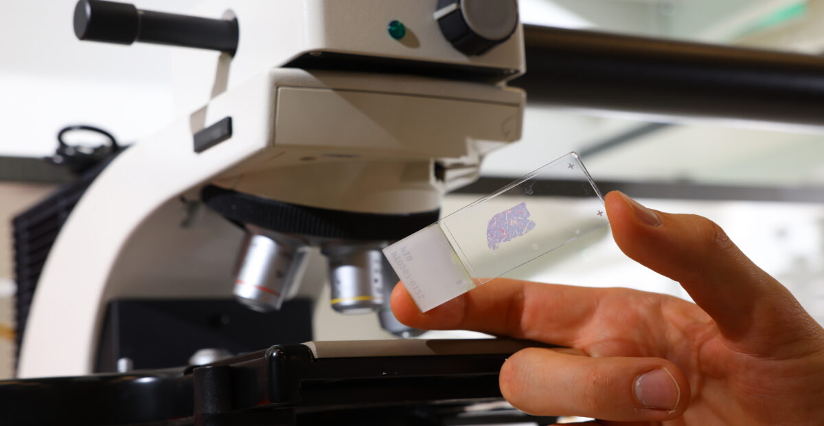 A microscope slide with a sample ready to use, held in front of a microscope.