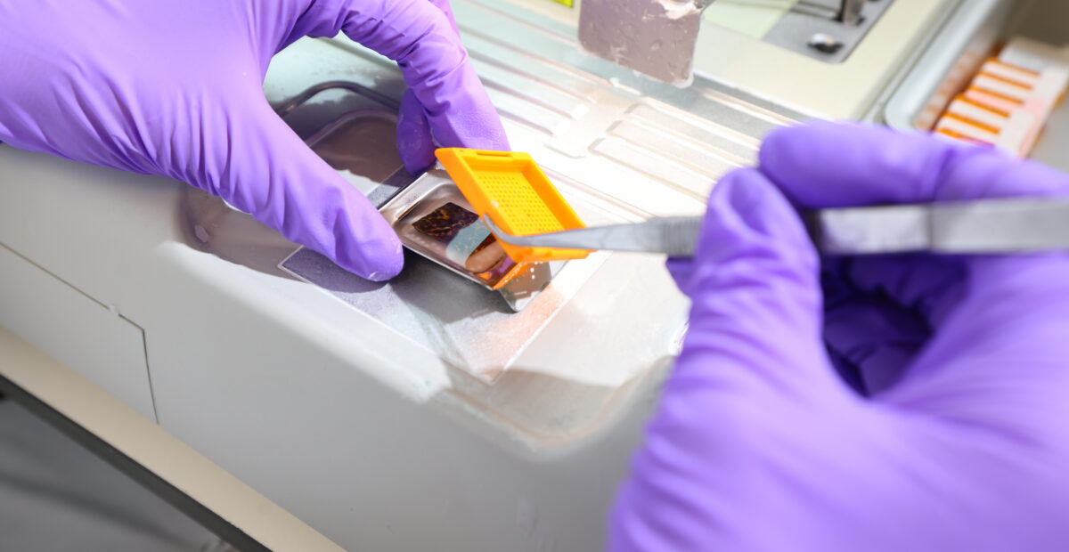 A scientist working on a sample using a metal tool, wearing purple gloves. They are lifting a small yellow cap from the sample.